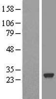 SDF2 Human Over-expression Lysate
