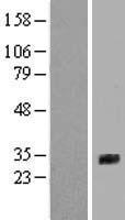 SFTPA2B Human Over-expression Lysate
