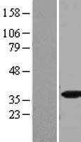 SFRS5 (SRSF5) Human Over-expression Lysate