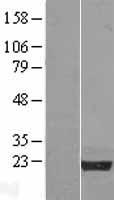 NPM3 Human Over-expression Lysate
