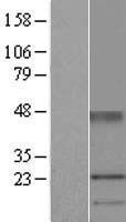 Uroplakin Ia (UPK1A) Human Over-expression Lysate