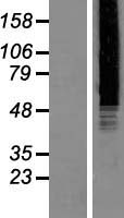 TRF41 (PAPD7) Human Over-expression Lysate