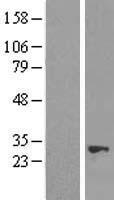 NUDT21 Human Over-expression Lysate