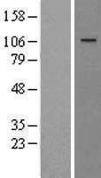 WWP1 Human Over-expression Lysate