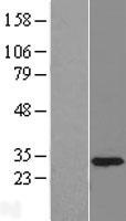 U1SNRNPBP (SNRNP35) Human Over-expression Lysate