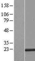 RER1 Human Over-expression Lysate