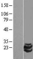 STMN2 Human Over-expression Lysate