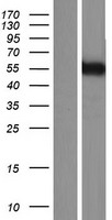 KATNA1 Human Over-expression Lysate