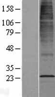 CYB561D2 Human Over-expression Lysate