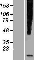 HHLA3 Human Over-expression Lysate