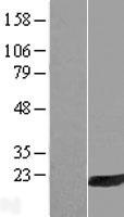HRASLS3 (PLA2G16) Human Over-expression Lysate