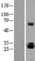 Thyrotropin Releasing Hormone (TRH) Human Over-expression Lysate