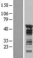CELF3 Human Over-expression Lysate