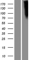 Frizzled 10 (FZD10) Human Over-expression Lysate