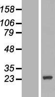 DCTN3 Human Over-expression Lysate