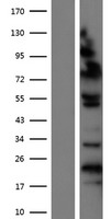 ZHX1 Human Over-expression Lysate