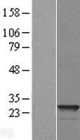 PMF1 Human Over-expression Lysate