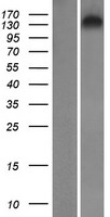 SYNRG Human Over-expression Lysate