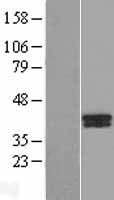 B4GALT7 Human Over-expression Lysate
