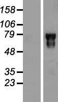 POU6F2 Human Over-expression Lysate