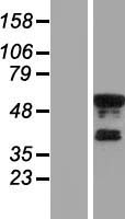 KLF8 Human Over-expression Lysate