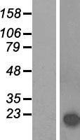 alpha Synuclein (SNCA) Human Over-expression Lysate