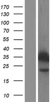 CYB5R3 Human Over-expression Lysate