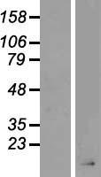 AGRP Human Over-expression Lysate