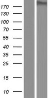 DLEC1 Human Over-expression Lysate