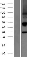 KLRC3 Human Over-expression Lysate