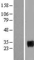 Homeobox protein SIX6 (SIX6) Human Over-expression Lysate