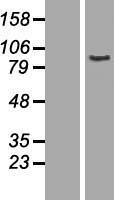 AOC2 Human Over-expression Lysate