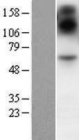 SIM2 Human Over-expression Lysate