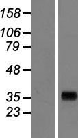 AKR7A3 Human Over-expression Lysate