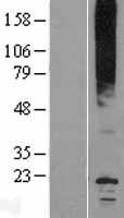 Aquaporin 0 (MIP) Human Over-expression Lysate