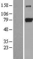 DRP1 (DNM1L) Human Over-expression Lysate
