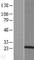 ARL5A Human Over-expression Lysate