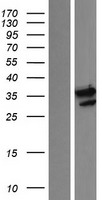 CCRK (CDK20) Human Over-expression Lysate