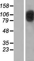 CDKN1A interacting zinc finger protein 1 (CIZ1) Human Over-expression Lysate