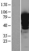 LMOD1 Human Over-expression Lysate