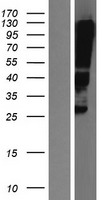 Claudin 12 (CLDN12) Human Over-expression Lysate