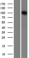DDX26 (INTS6) Human Over-expression Lysate