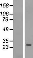 FBXO25 Human Over-expression Lysate