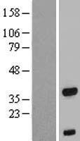 FOXB1 Human Over-expression Lysate