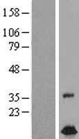 FXC1 (TIMM10B) Human Over-expression Lysate