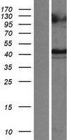 TIM 1 (HAVCR1) Human Over-expression Lysate