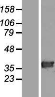 HAAO Human Over-expression Lysate