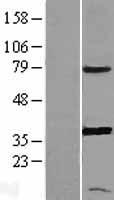 PTGR1 Human Over-expression Lysate