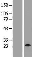 MRAS Human Over-expression Lysate