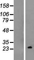 TC10 (RHOQ) Human Over-expression Lysate